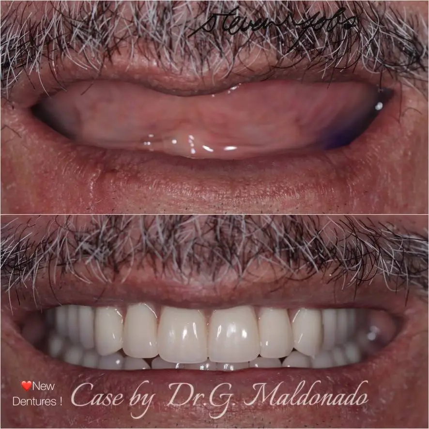 Dentistas Hispanos