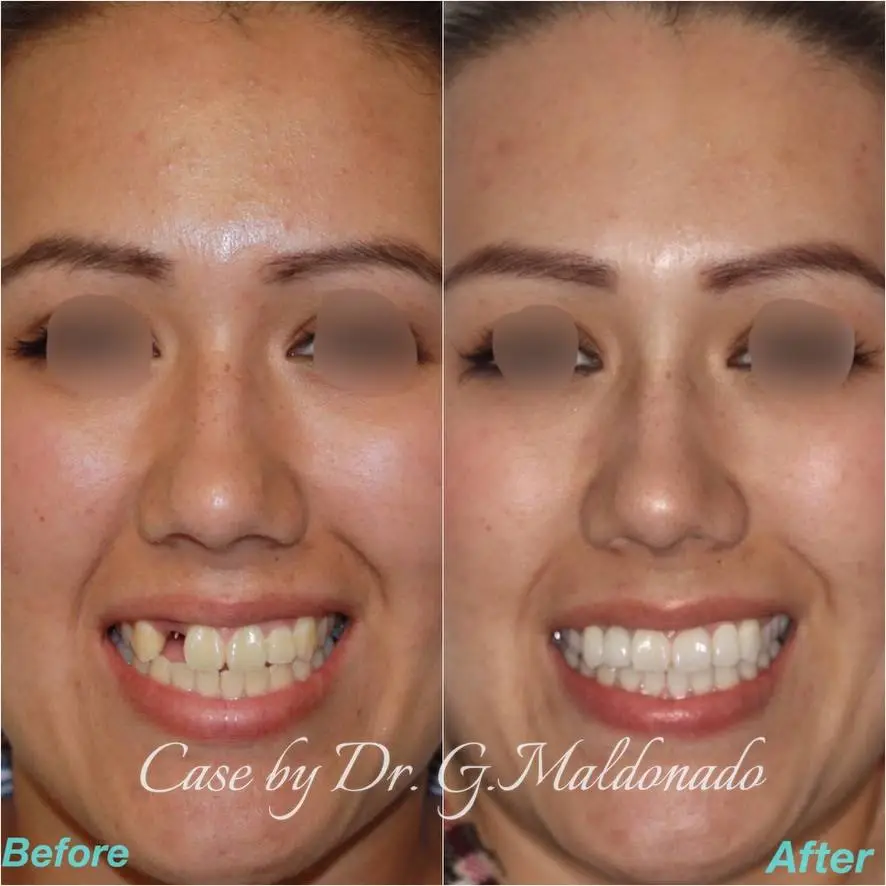 Dentistas Hispanos