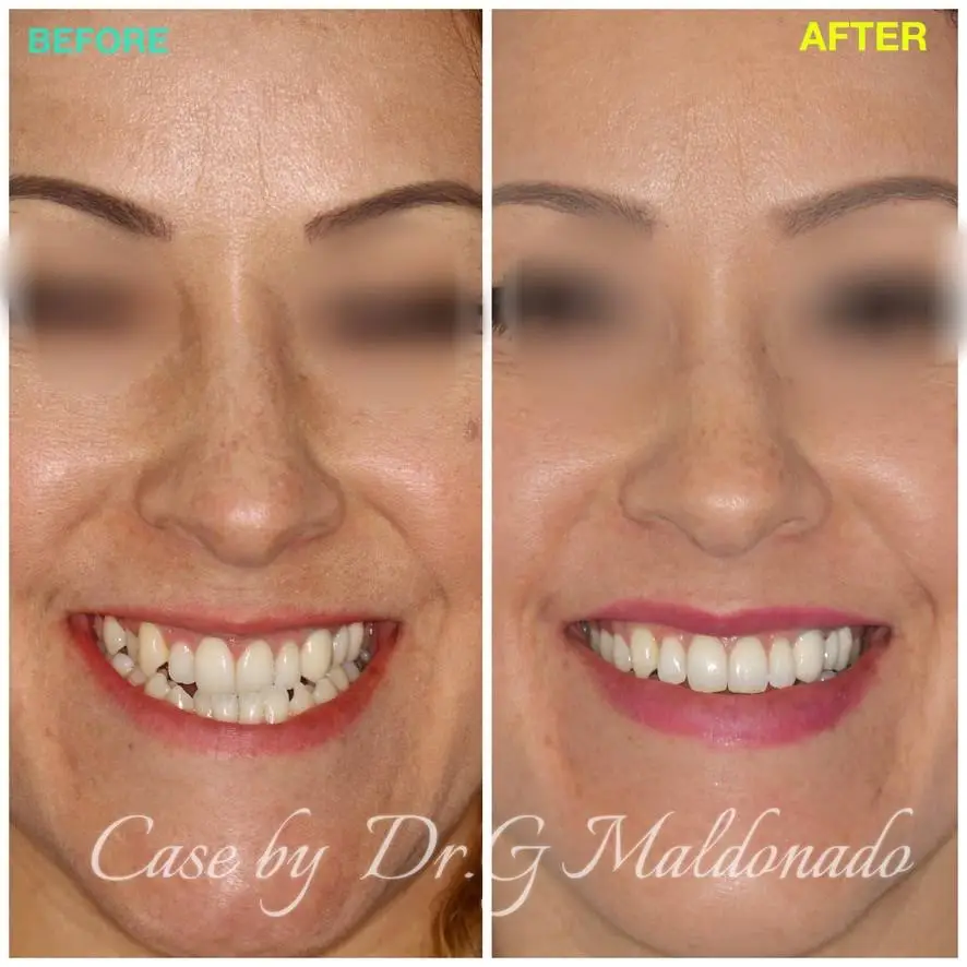 Dentistas Hispanos