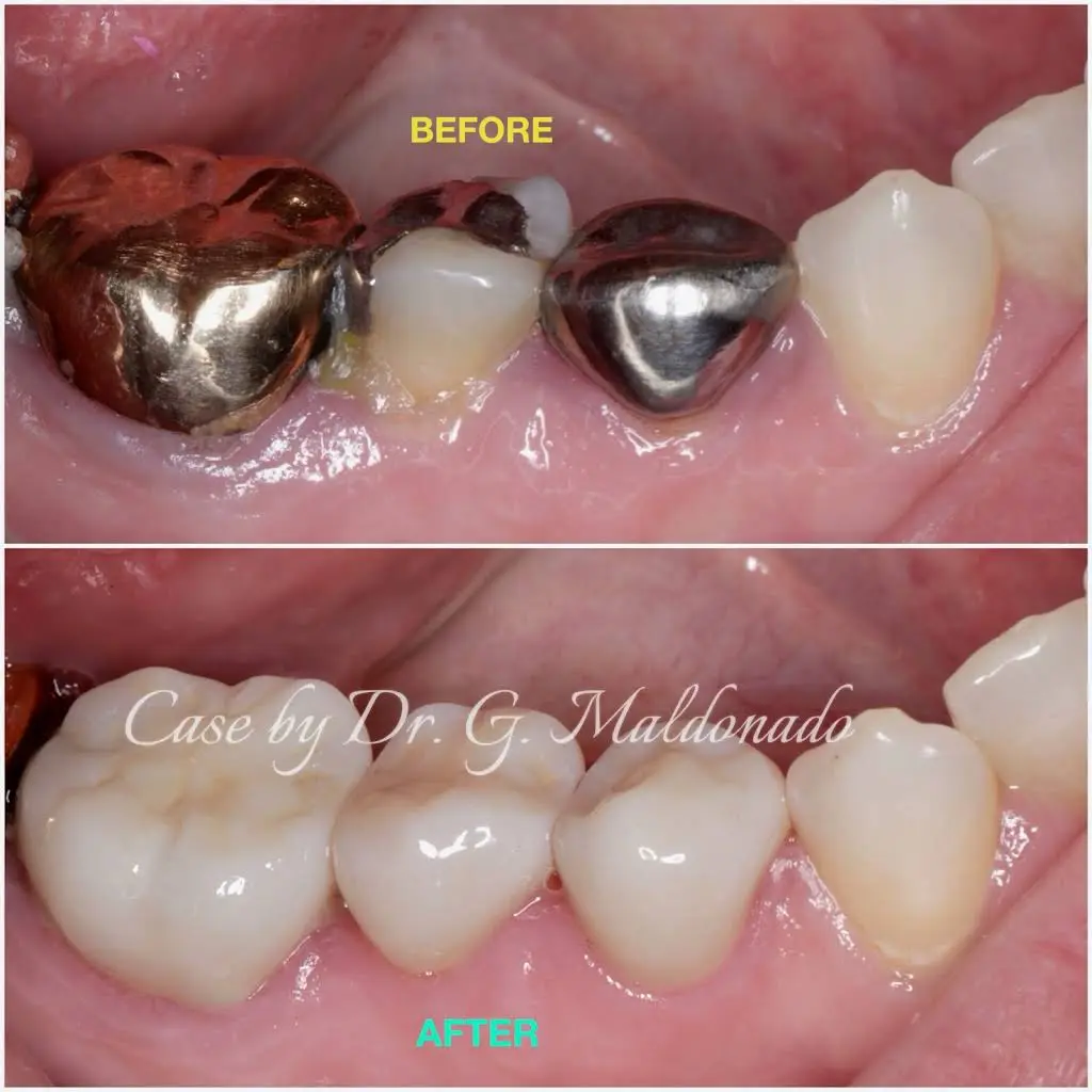 Dentistas Hispanos