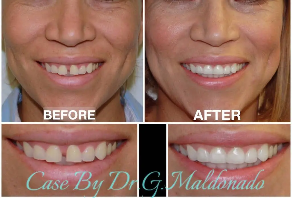 Dentistas Hispanos
