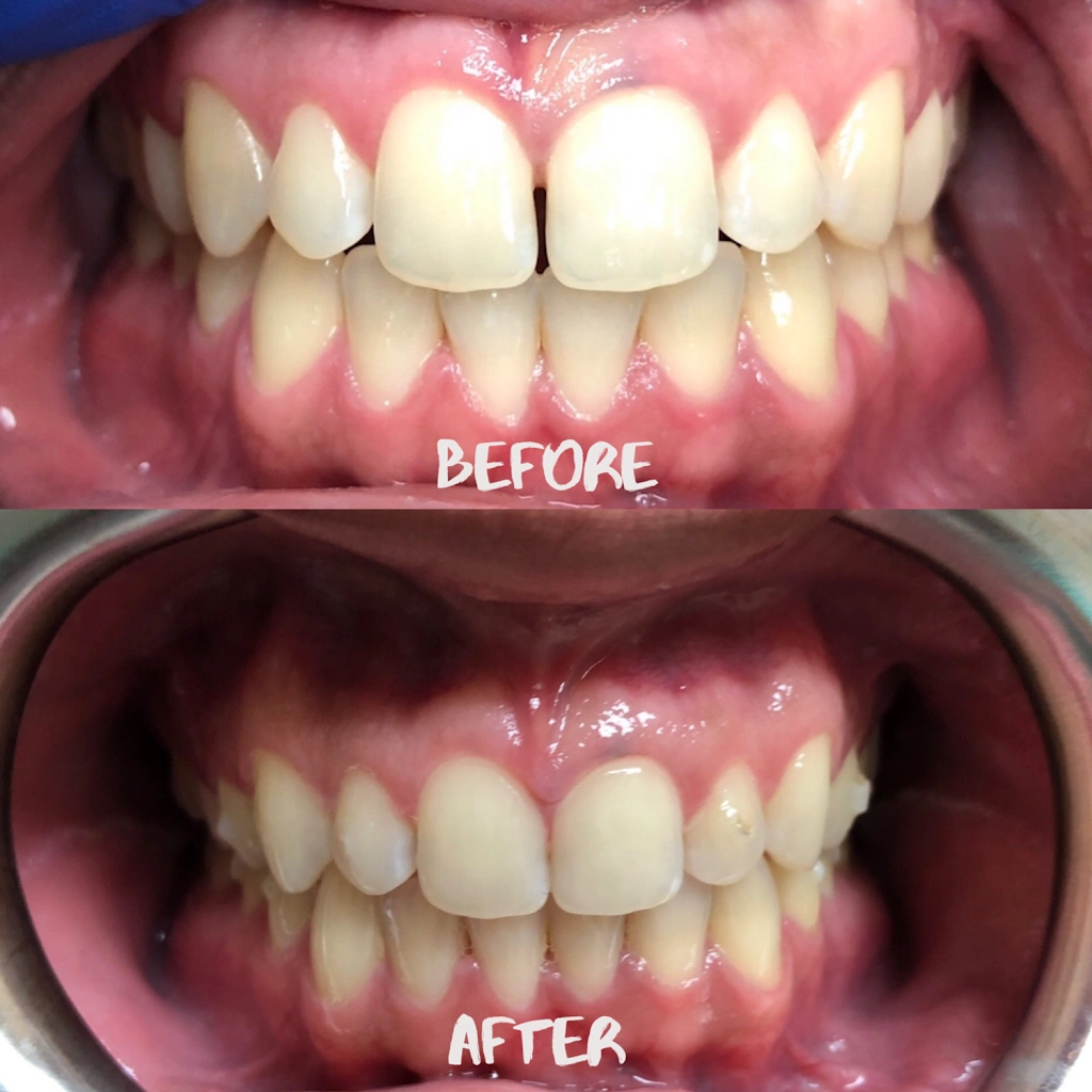 Bedford Dental & Braces