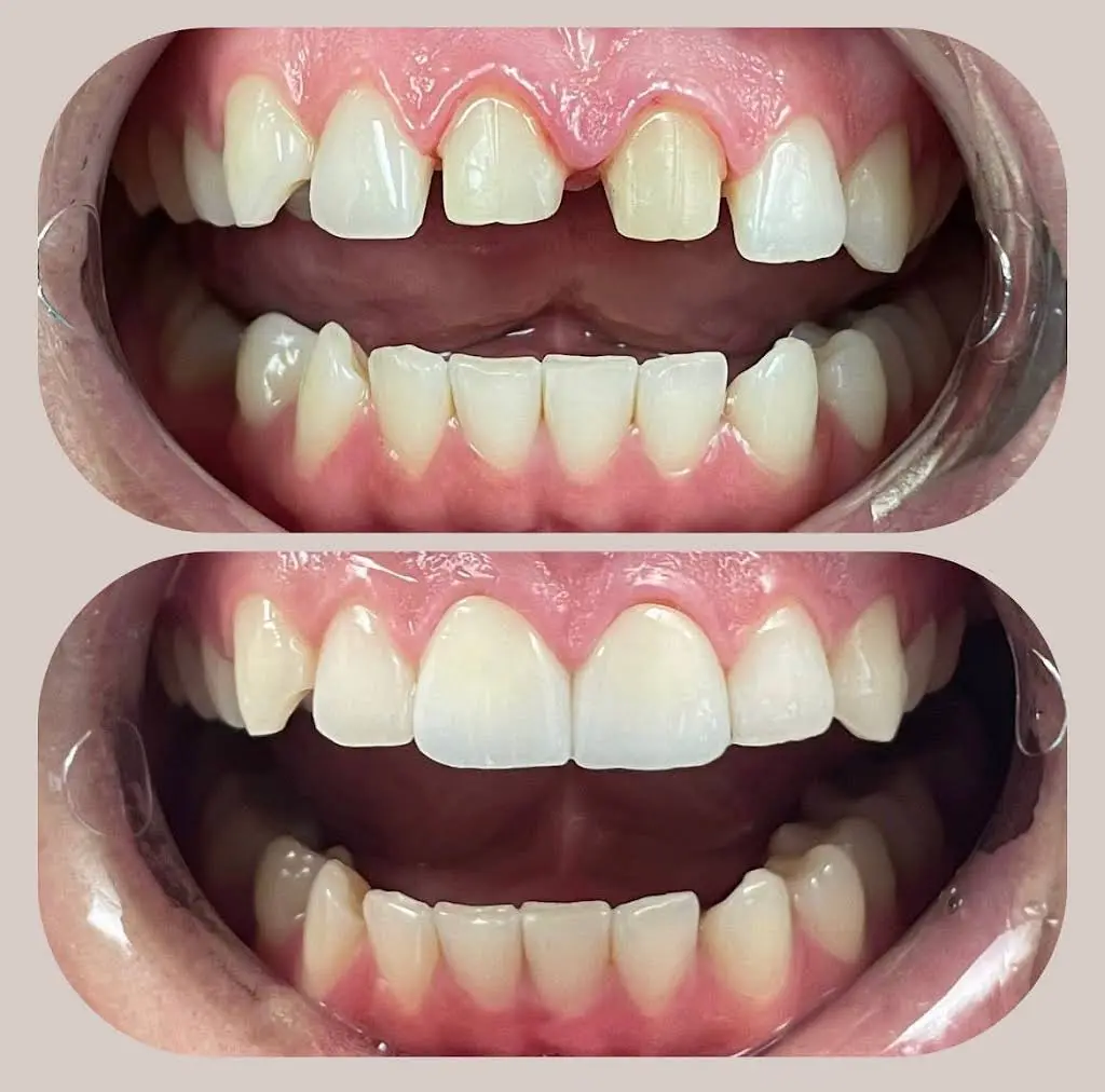 Avila Dental