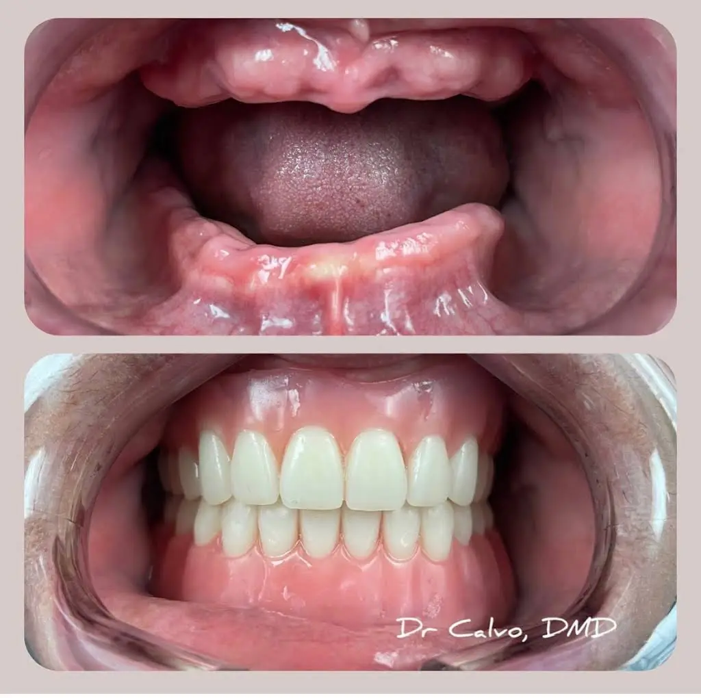 Avila Dental