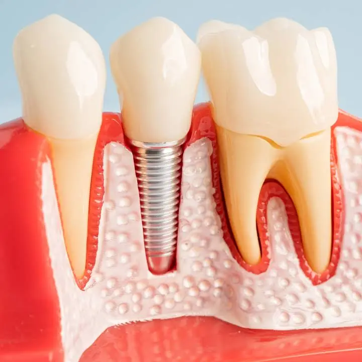 Finesse Dental Care