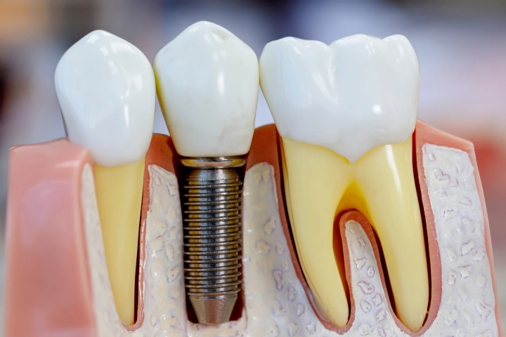 Pacific Smiling Dental & Orthodontics