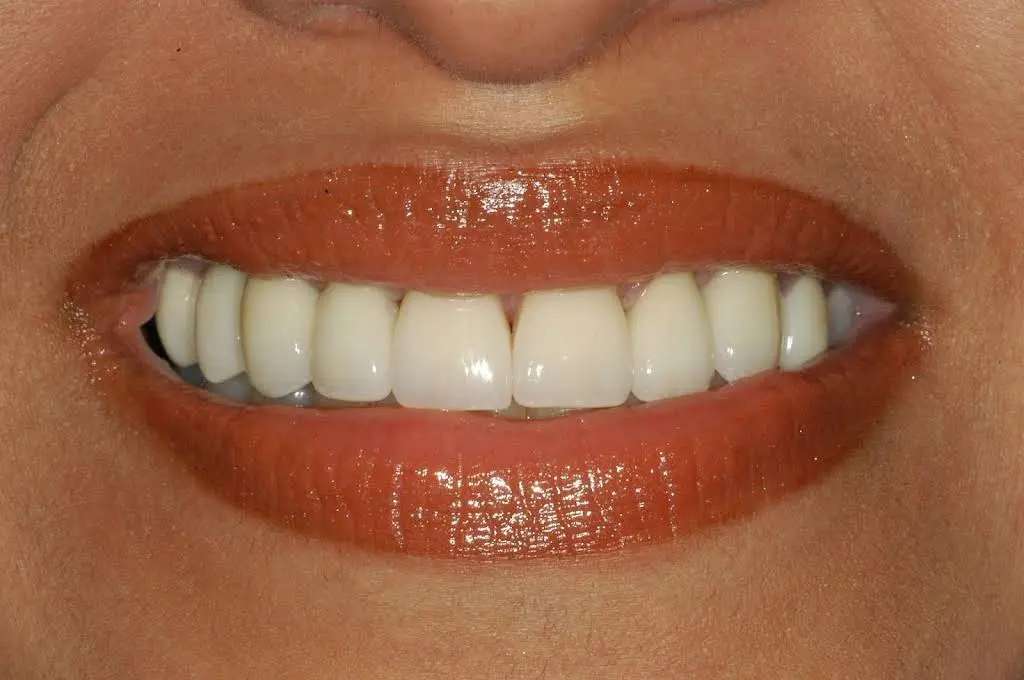 Hidden Lakes Dental Care