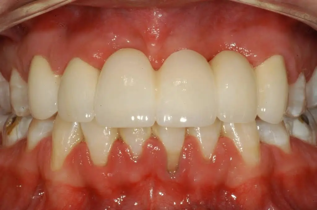 Hidden Lakes Dental Care