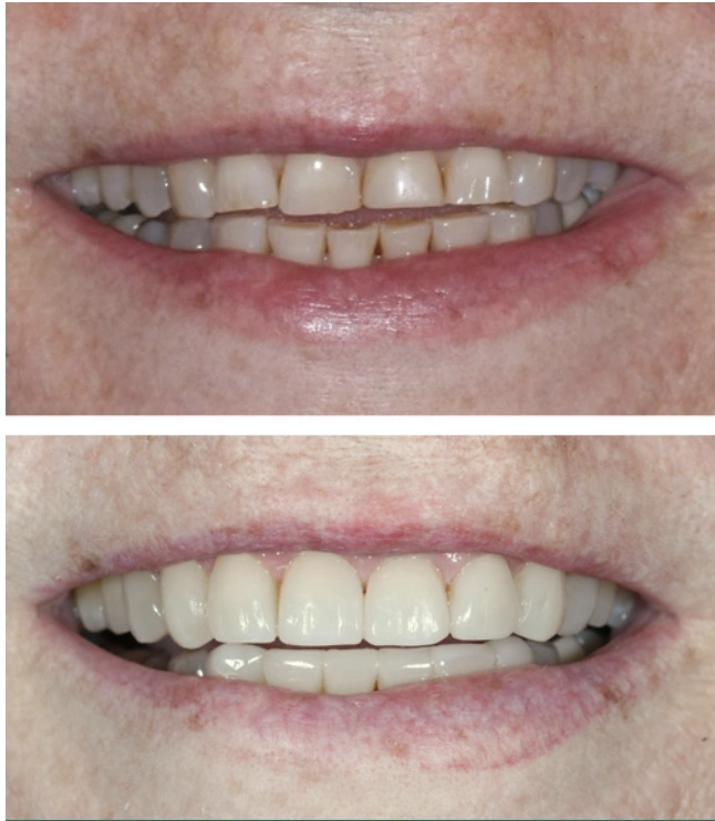 Aesthetic Family Dentistry