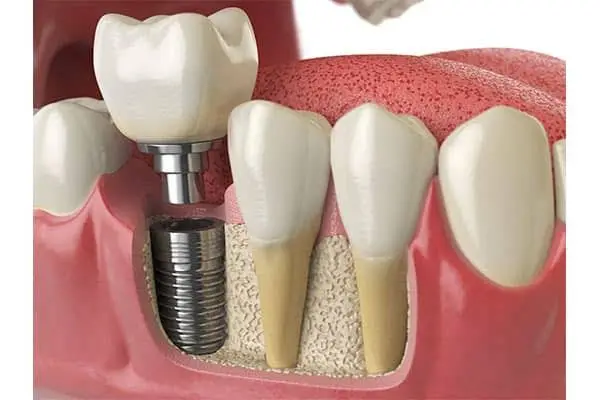 Palisades Dental