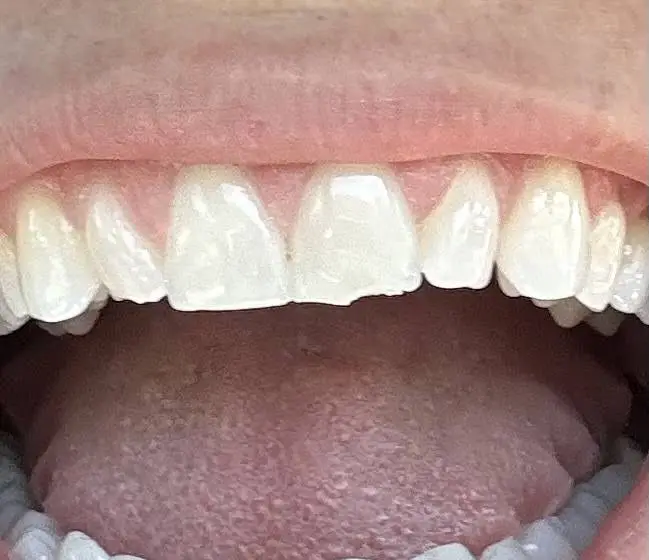 Palisades Dental