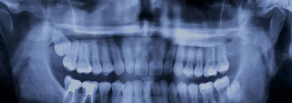 Palisades Dental