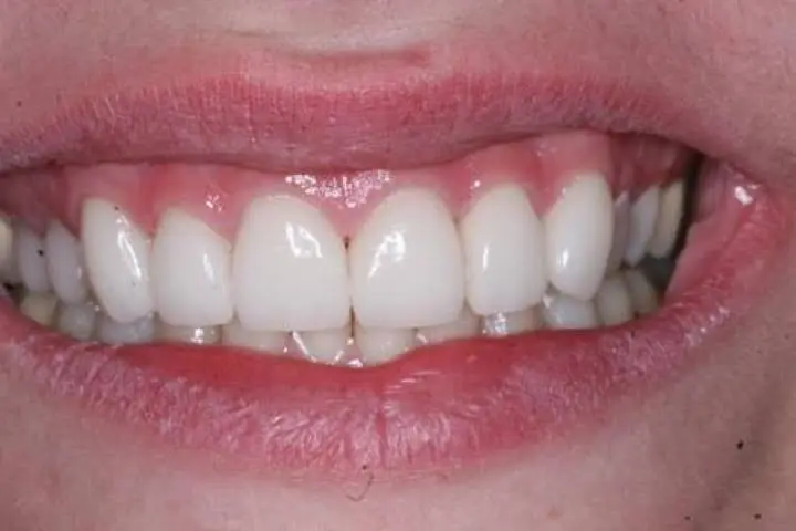 Elite Dental American Fork
