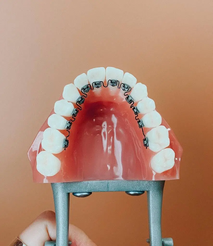 Smile Perfect Orthodontics