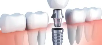 Cedar Hills Family Dentistry