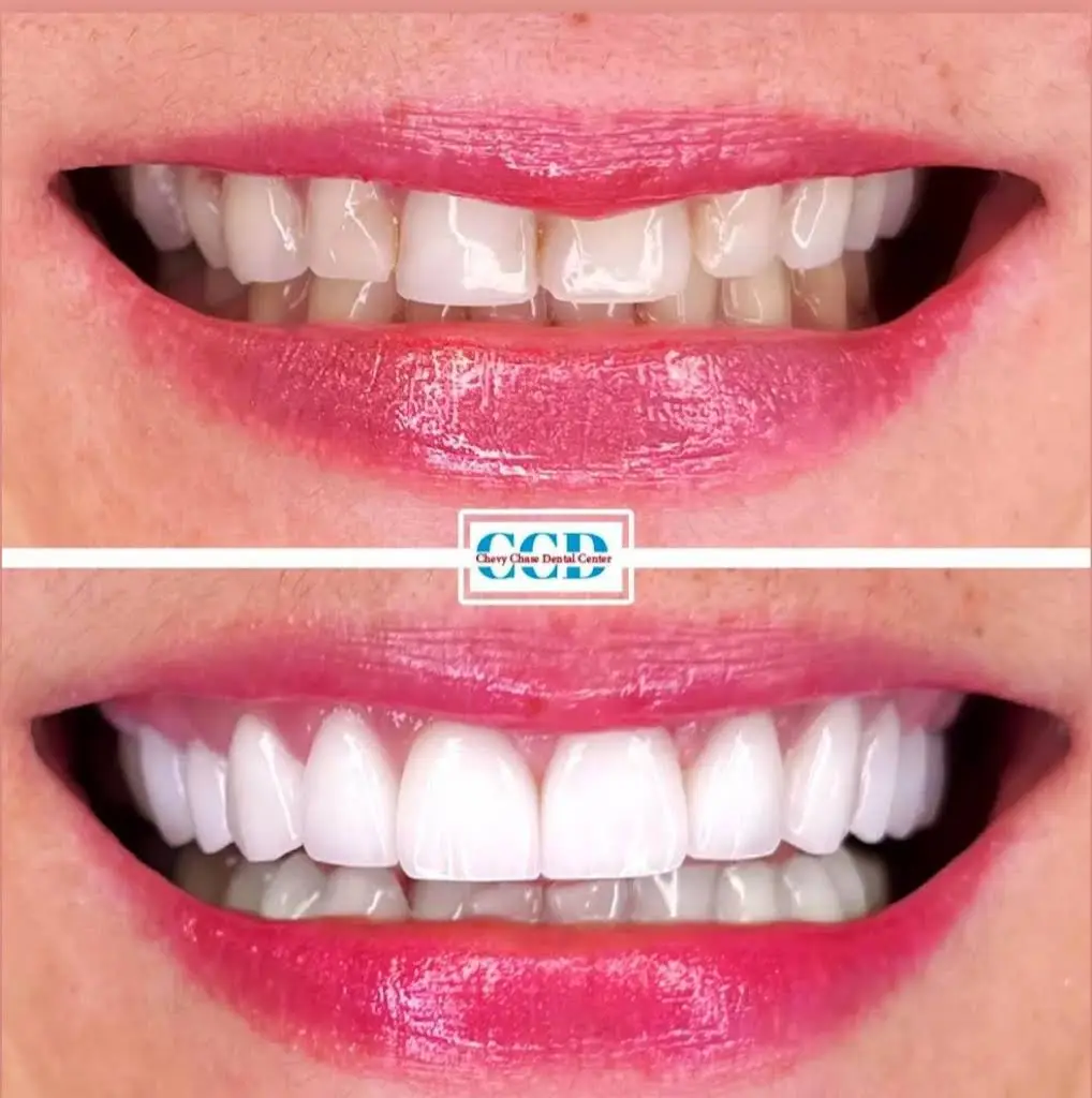 Chevy Chase Dental Center