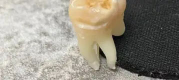 America Dental Services