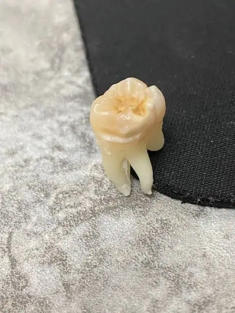 America Dental Services