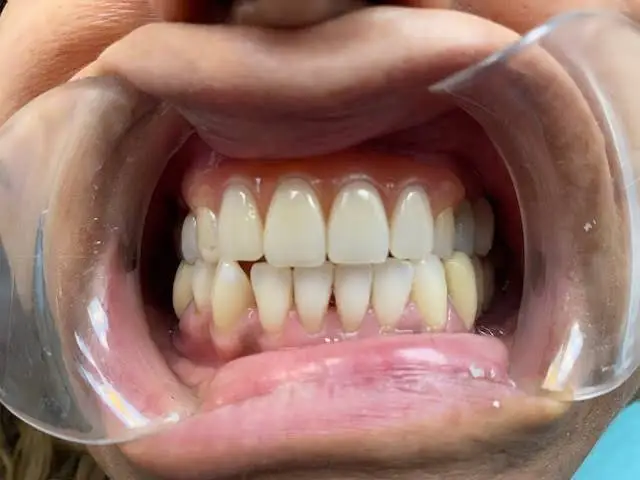 America Dental Services