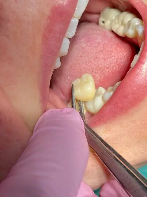 America Dental Services
