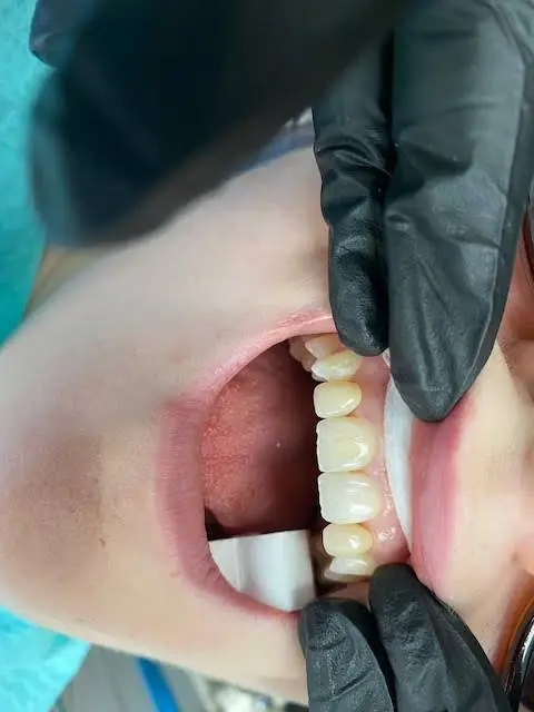 America Dental Services