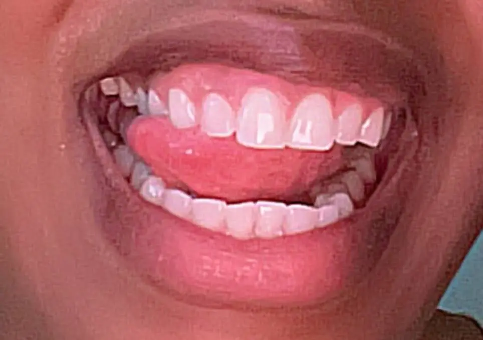 Nova Family Dentistry of Tyrone