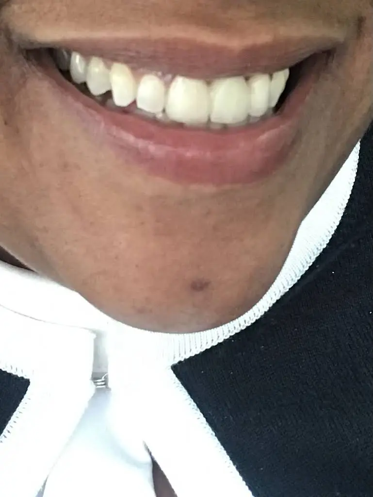 Great Expressions Dental Centers - Fayetteville