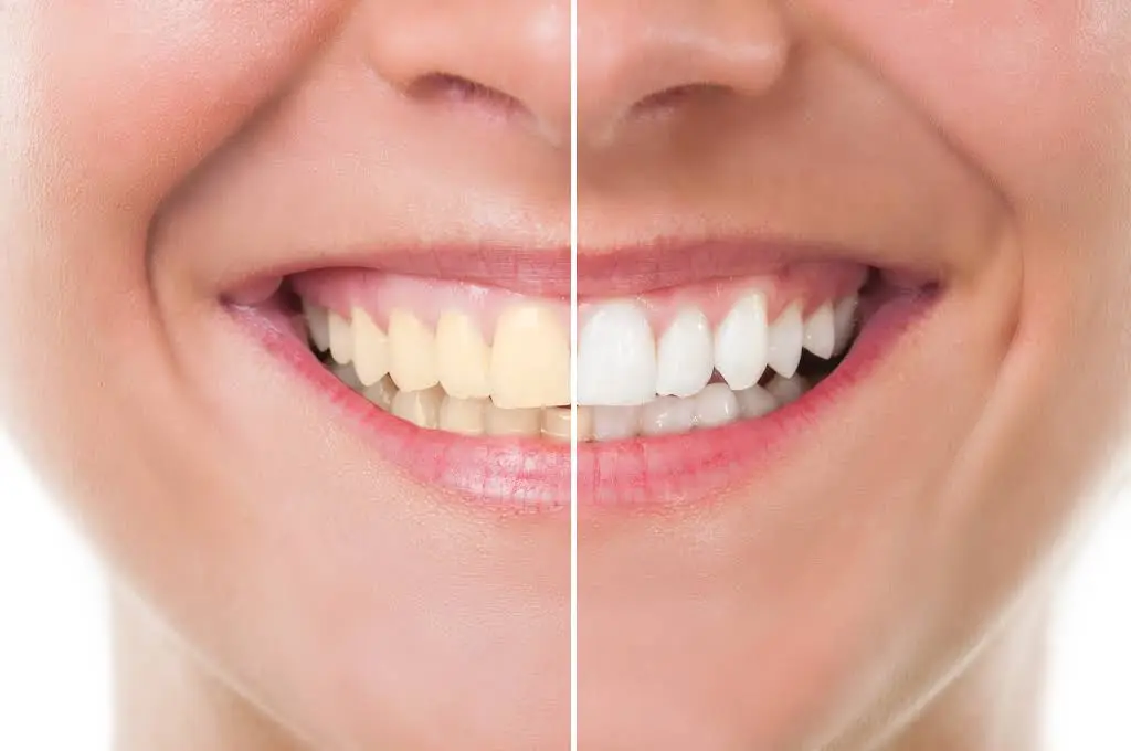 All Family Dental and Braces