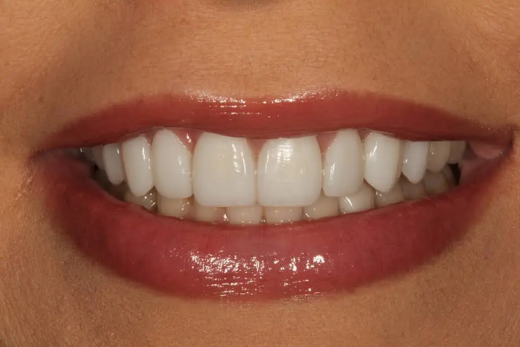 AH Smiles: Brent A. Engelberg, DDS