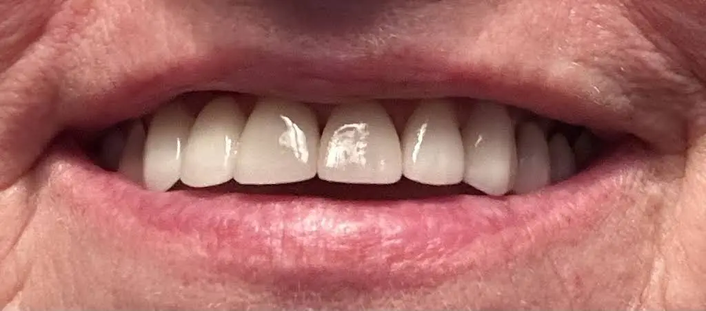 Lind Dental Care