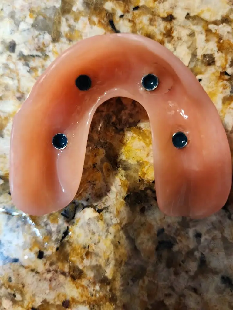Affordable Dentures & Implants