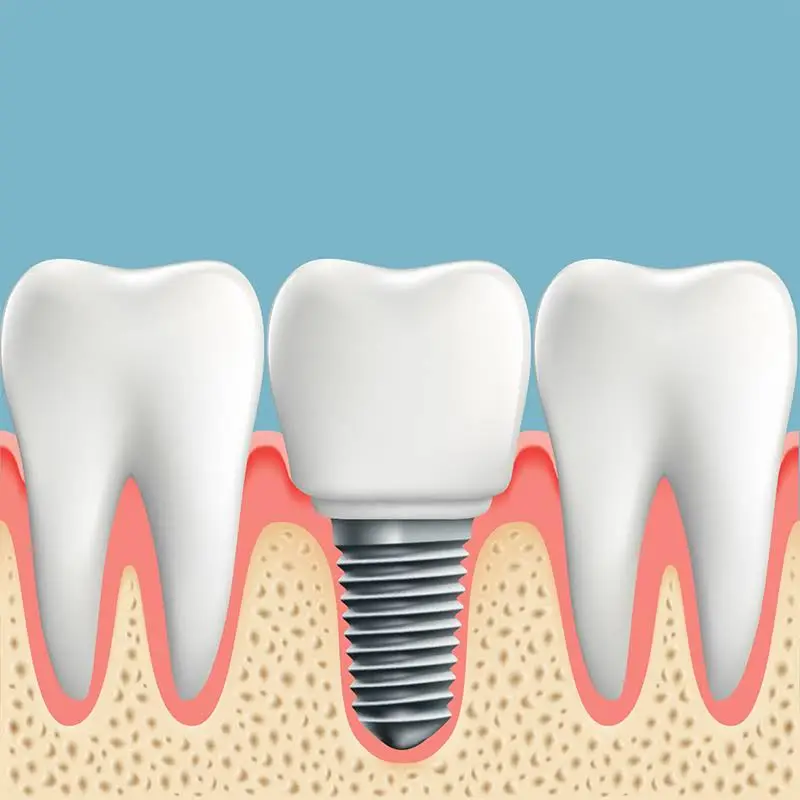 Diamond Dental Service