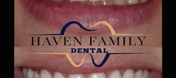 Haven Family Dental - Dr. Bottros