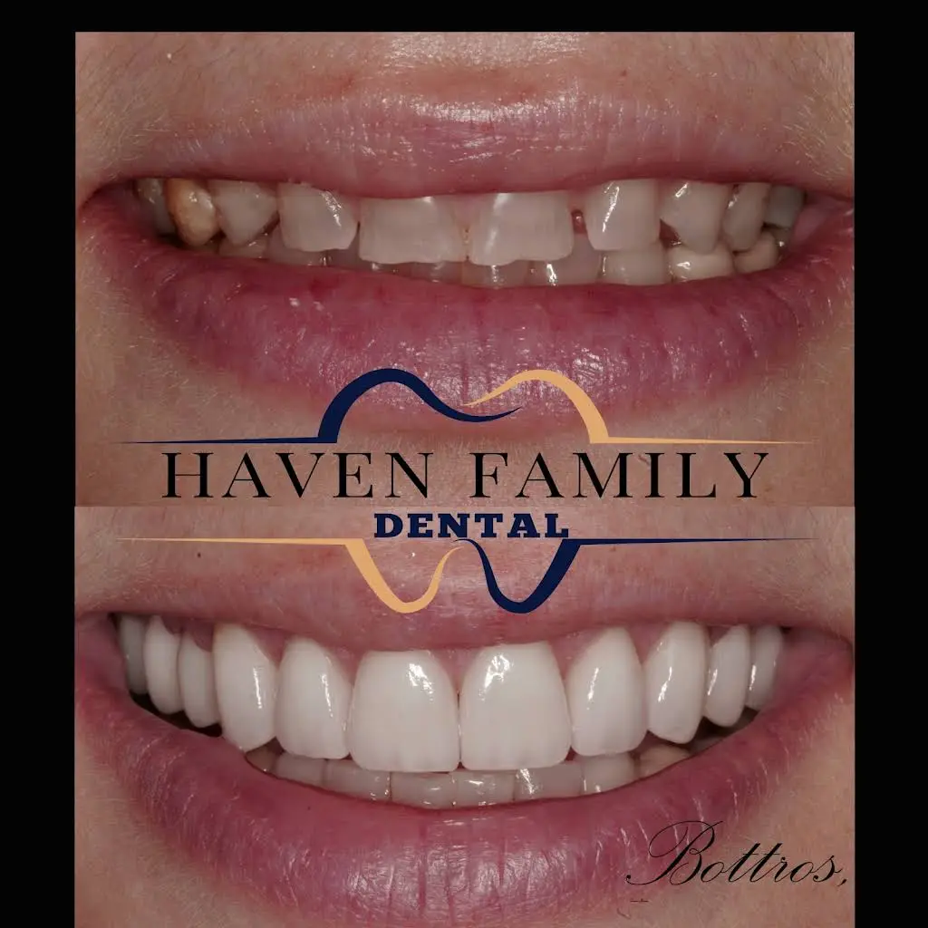 Haven Family Dental - Dr. Bottros