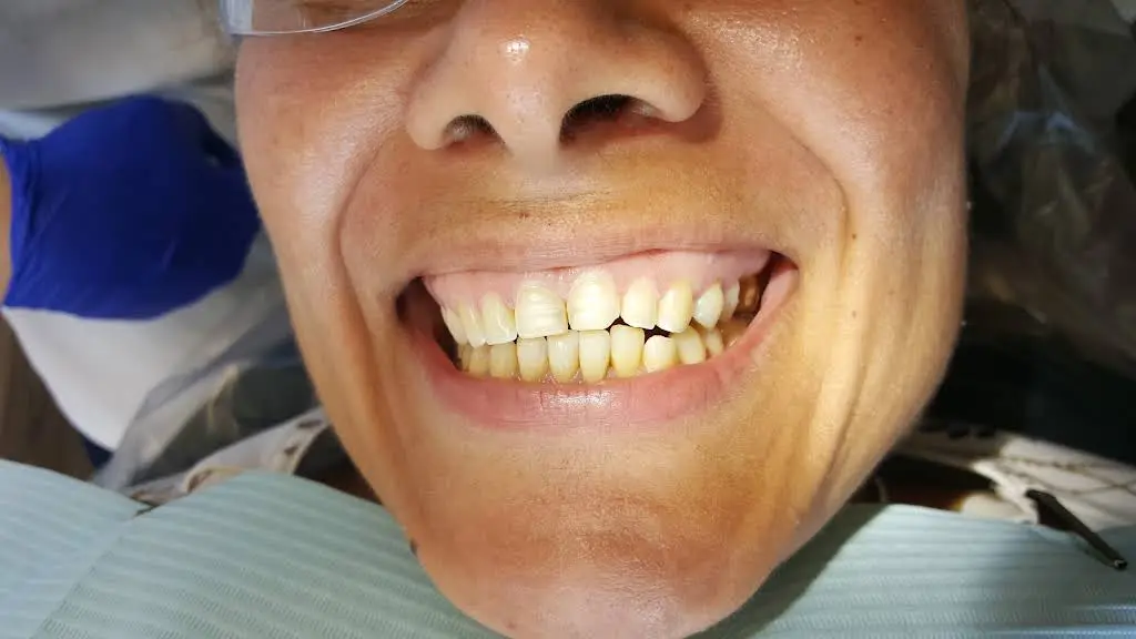 Shining Smiles Dentistry
