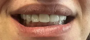 Apex Dental Care