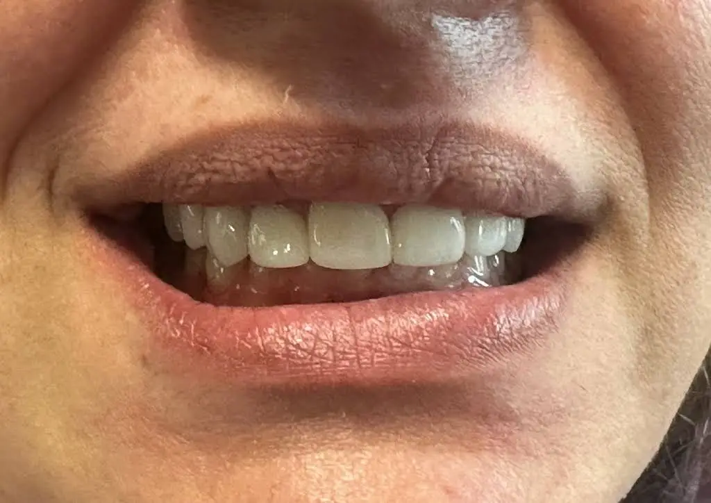 Apex Dental Care