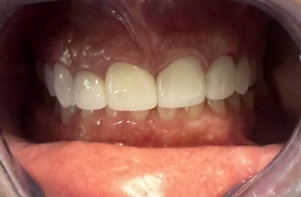 Apex Dental Care