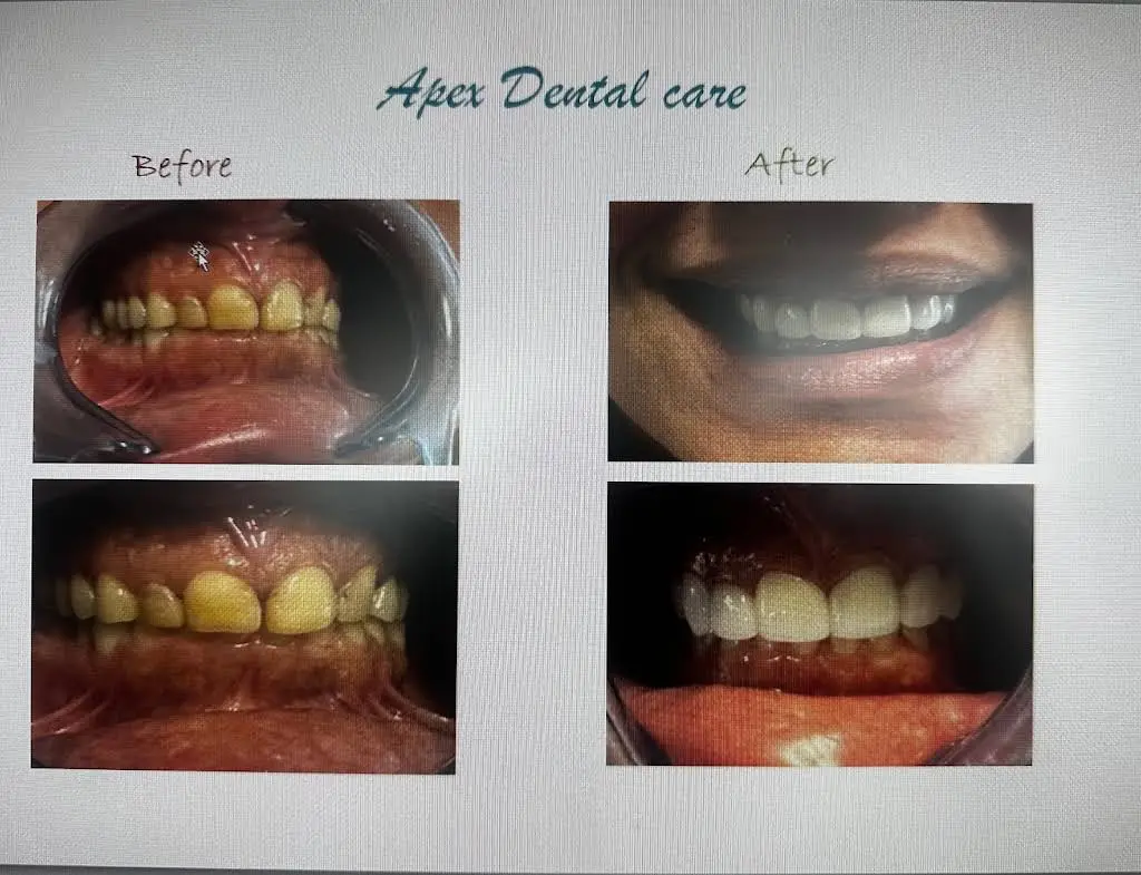 Apex Dental Care