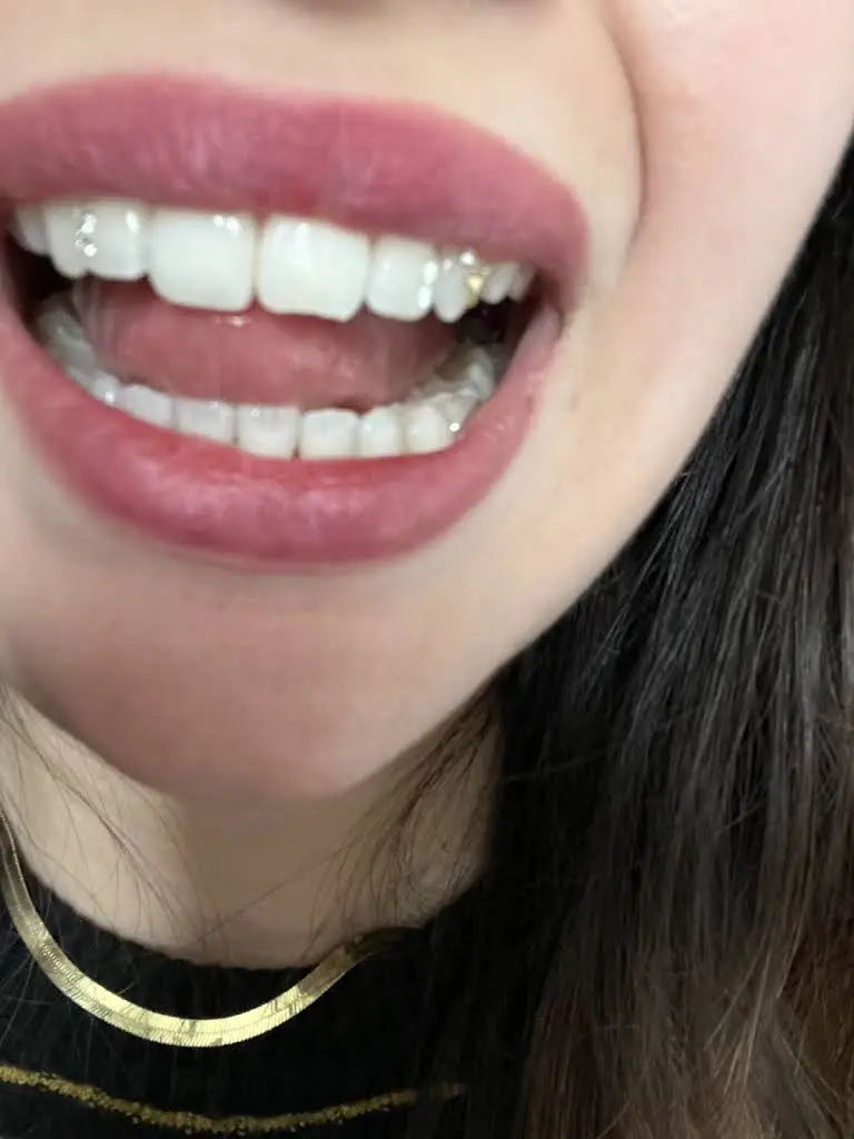 Bucktown Wicker Park Dental