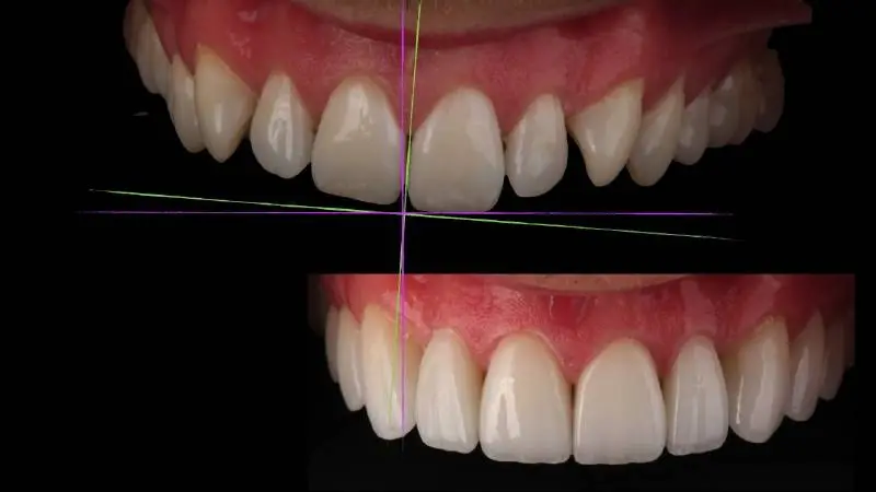 Chicago Dental Esthetics: Samantha Rabor, DDS