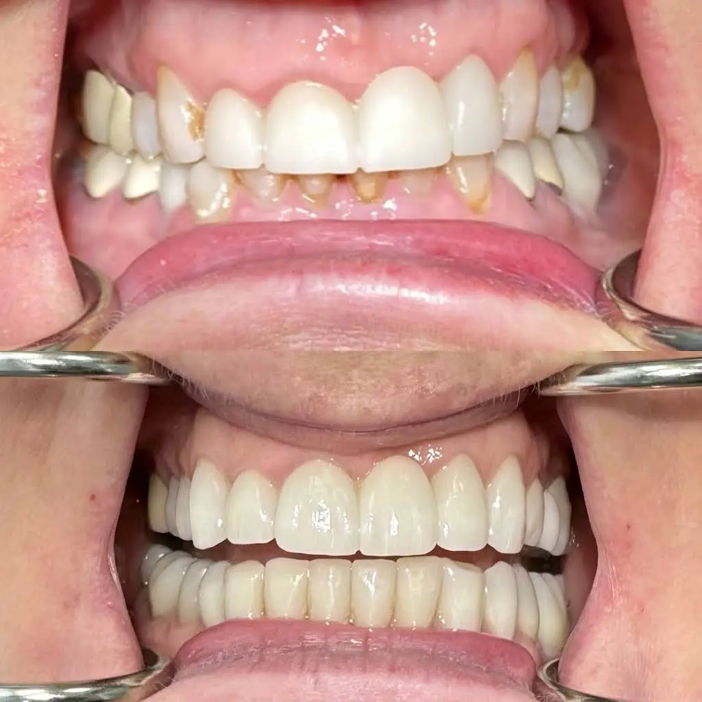 Lincoln Square Dental Spa