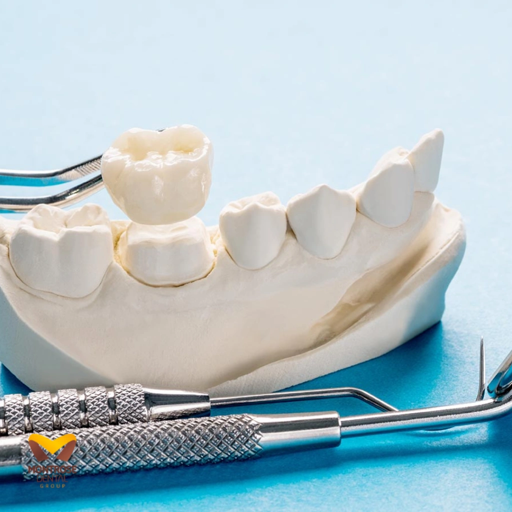 Montrose Dental Group
