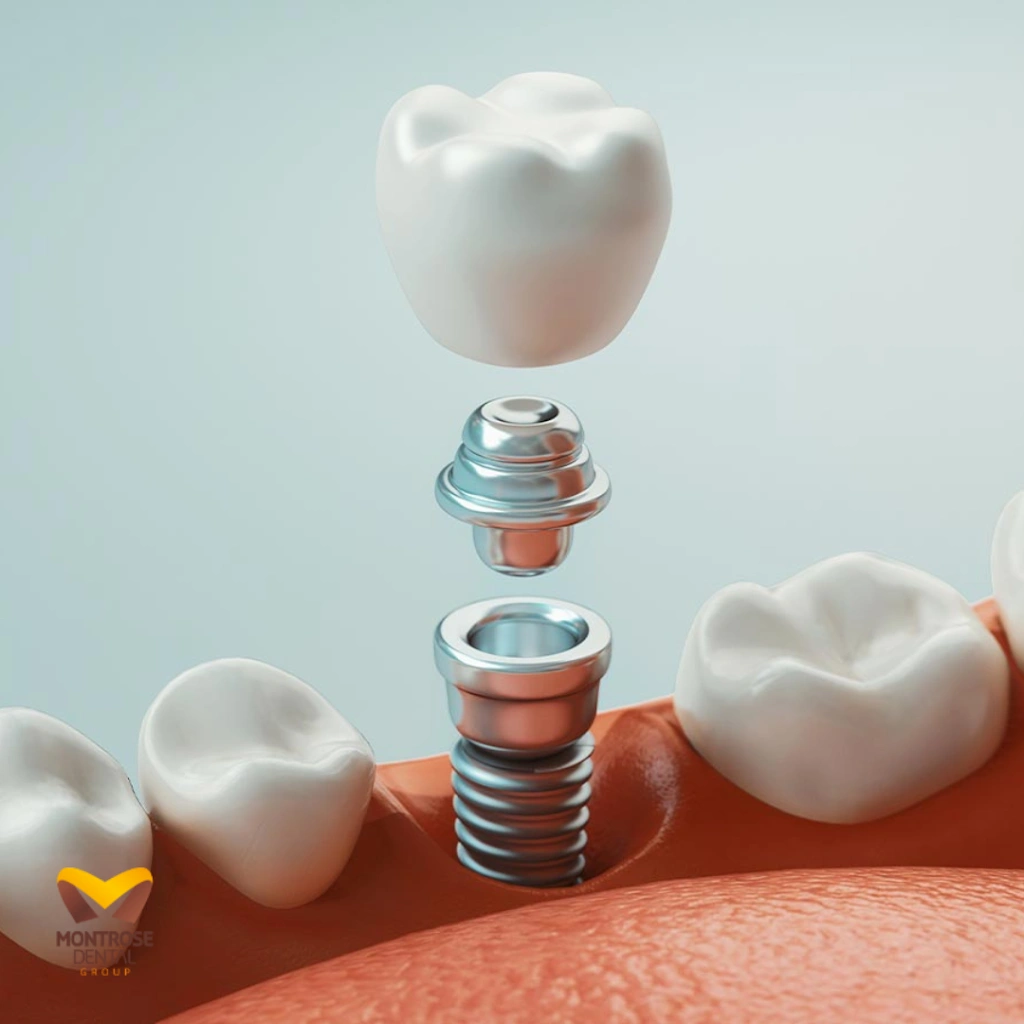 Montrose Dental Group