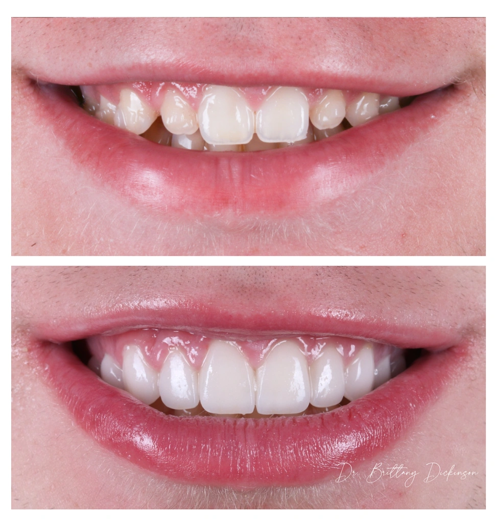 Chicago Aesthetic Dentistry