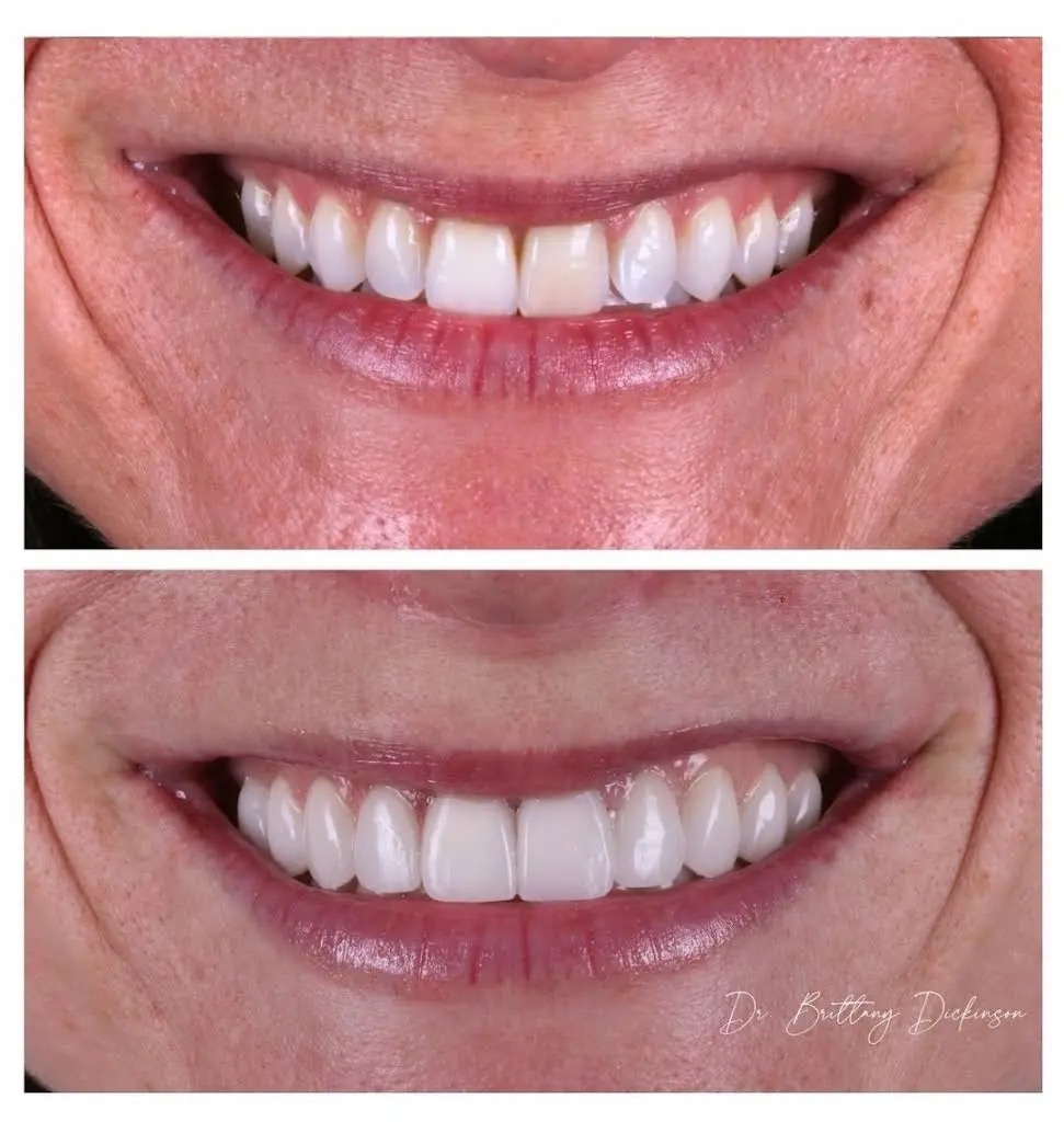 Chicago Aesthetic Dentistry