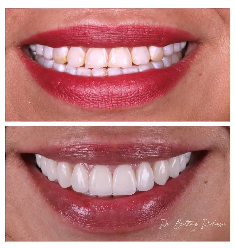 Chicago Aesthetic Dentistry