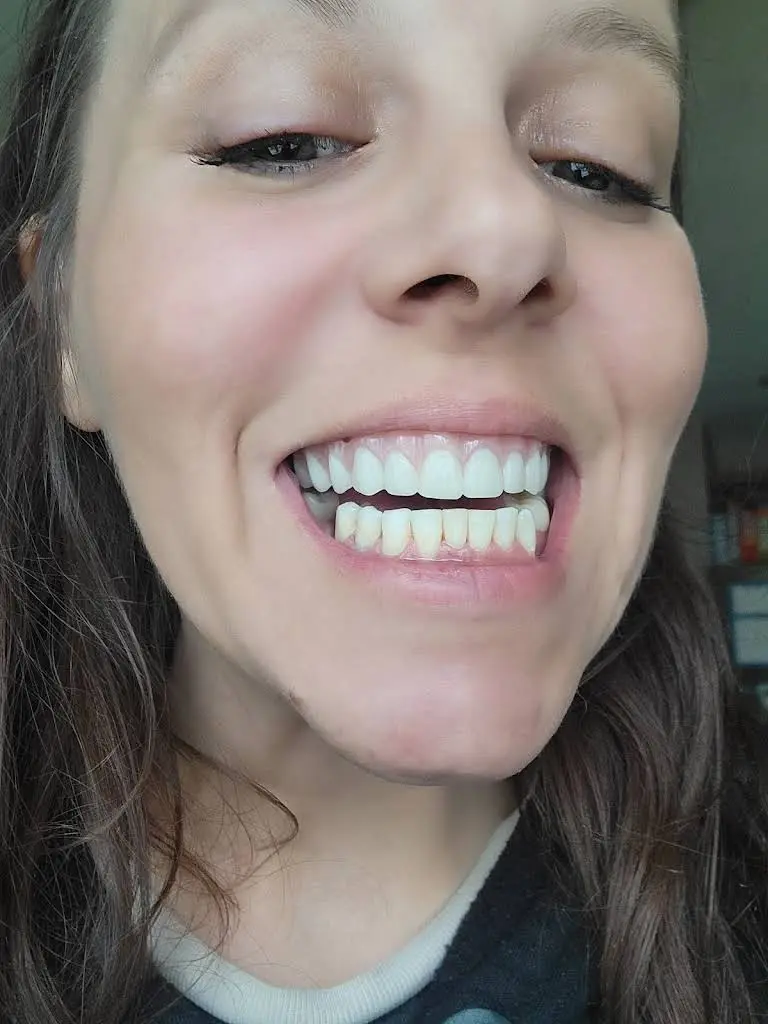Kapur Dental