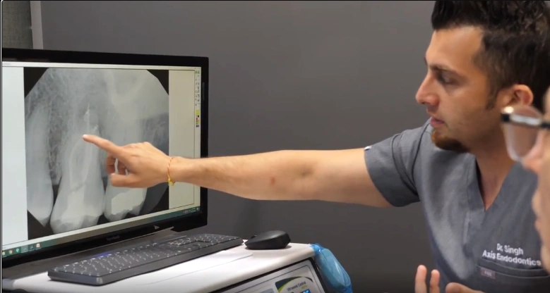 Axis Endodontics