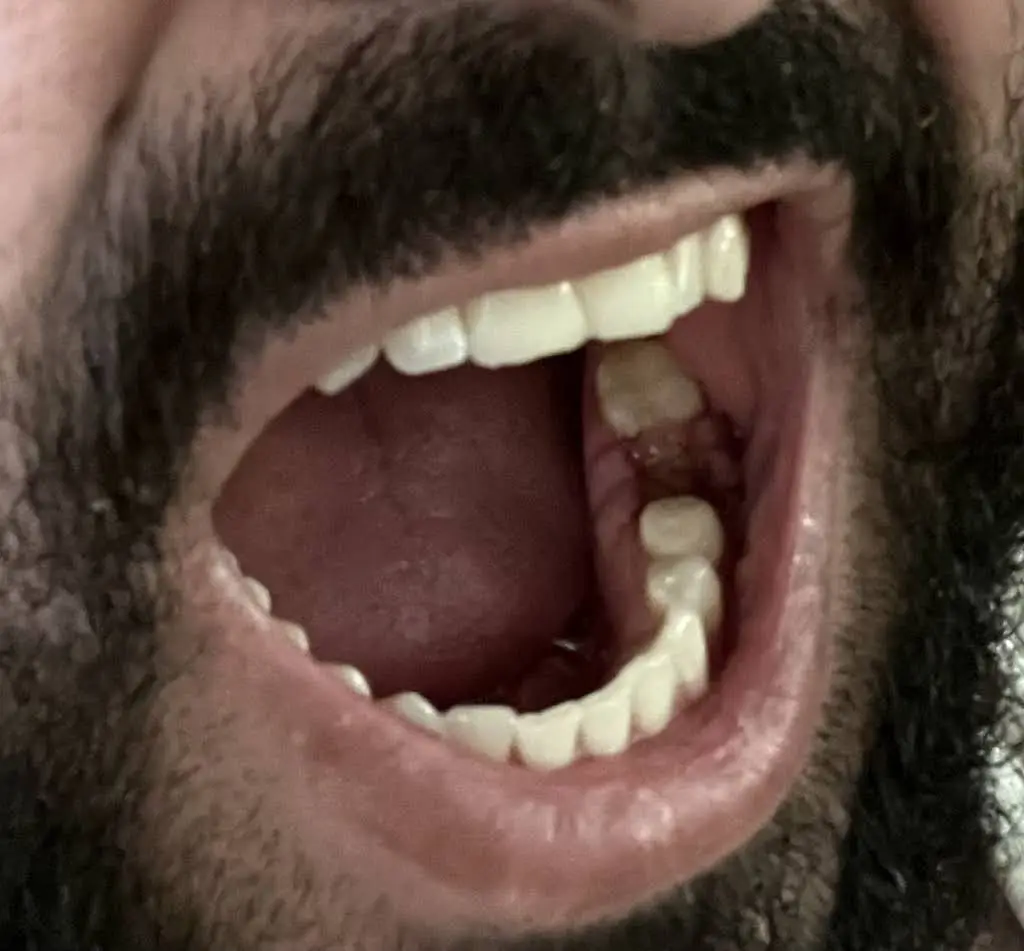 Axis Endodontics